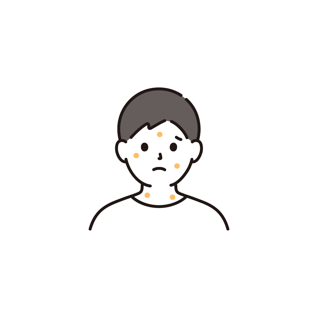 湿疹・男性