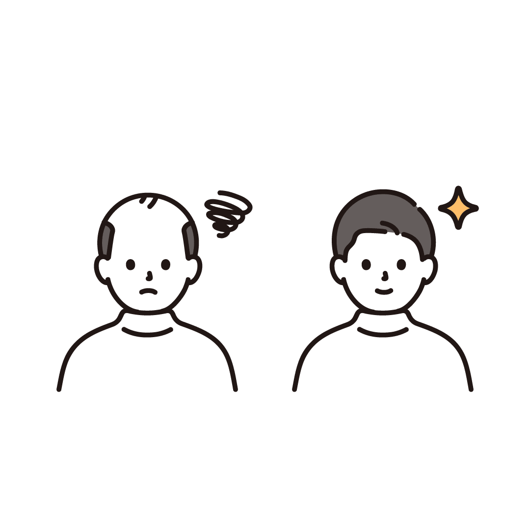 薄毛に悩む男性のビフォーアフター