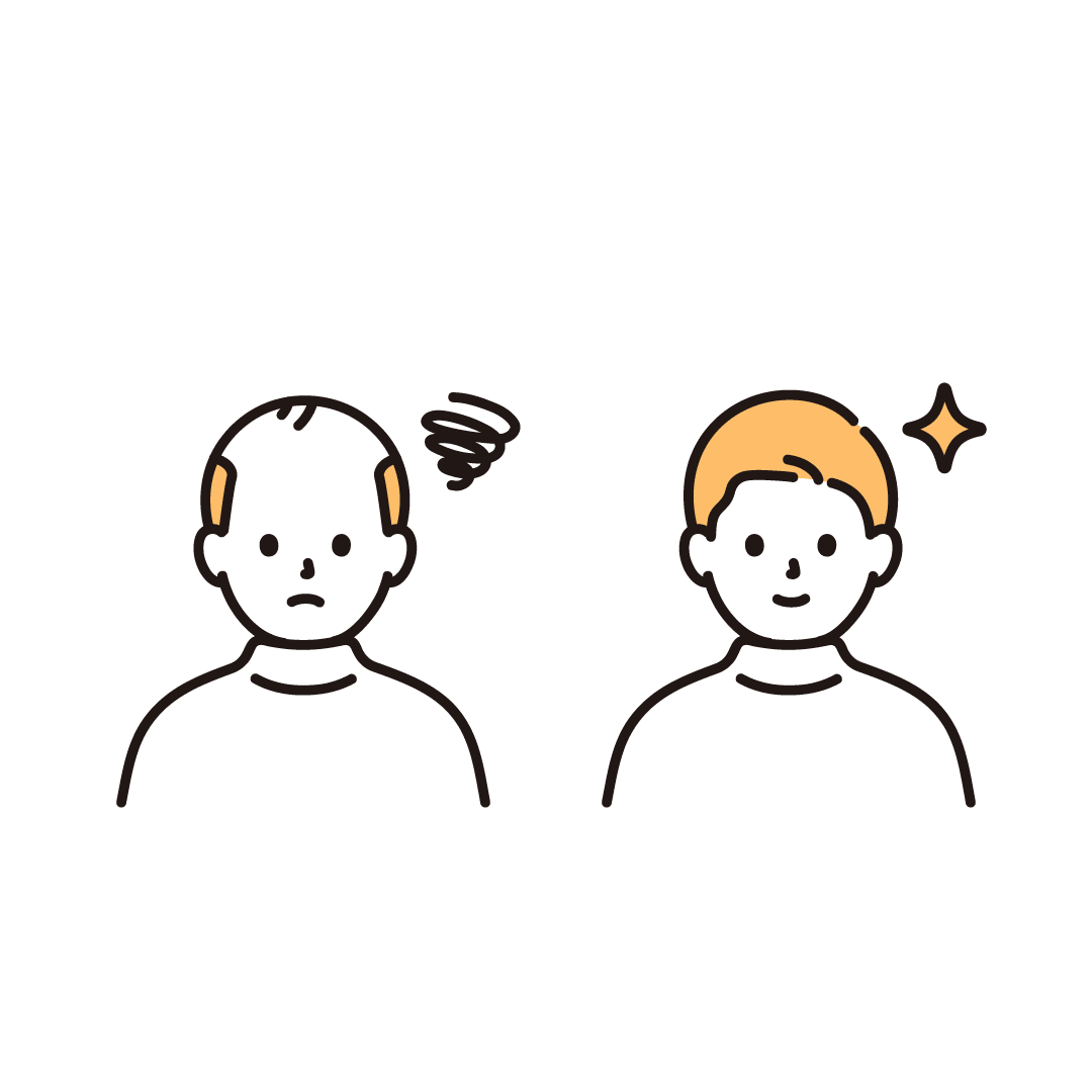 薄毛に悩む男性のビフォーアフター